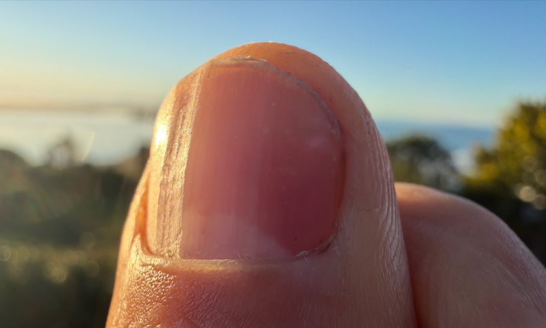 Close-up of natural fingernail showing vertical ridges