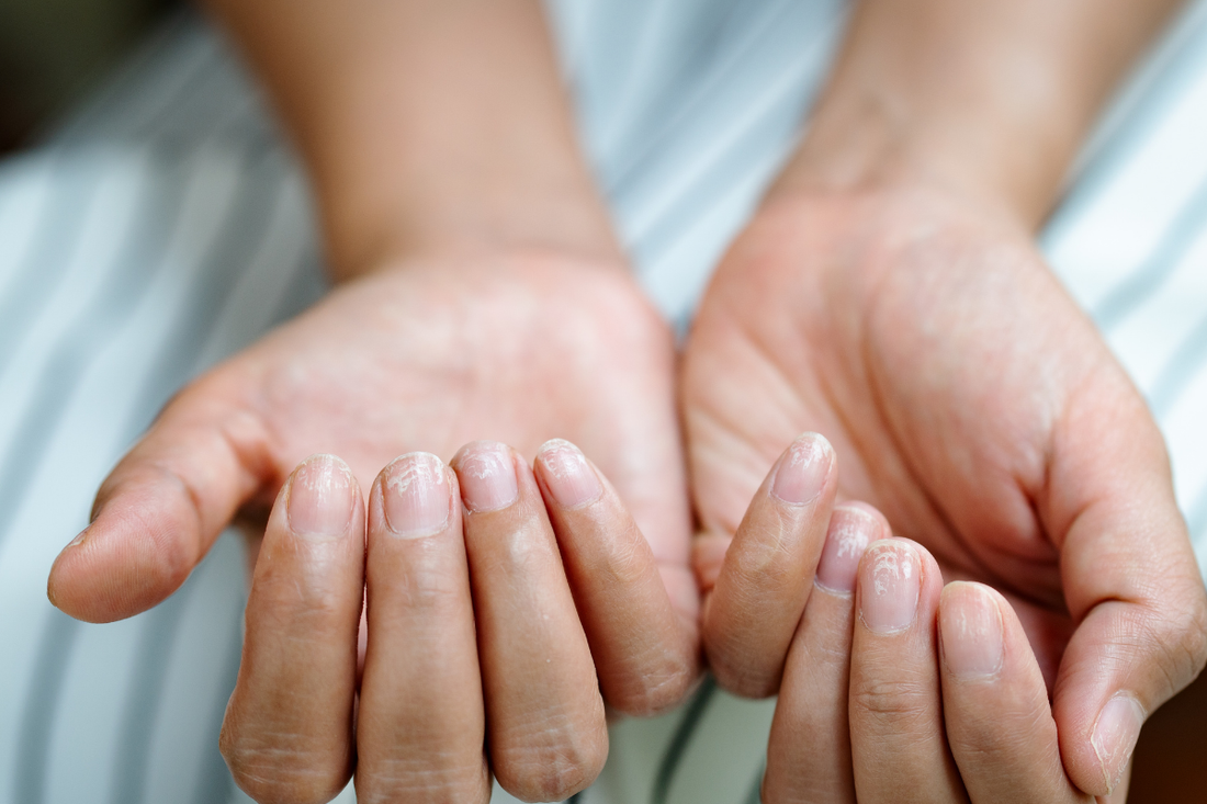 Best Nail Strengthener for Brittle Nails: What Actually Works
