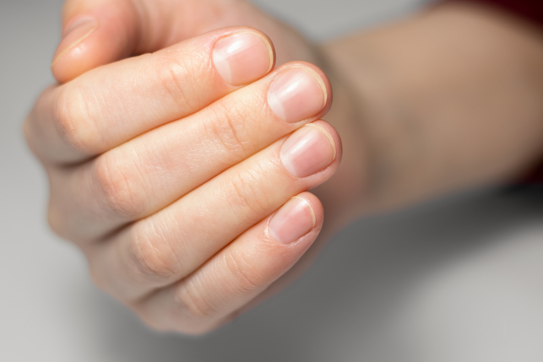 Why Do My Nails Keep Breaking? Causes and Solutions